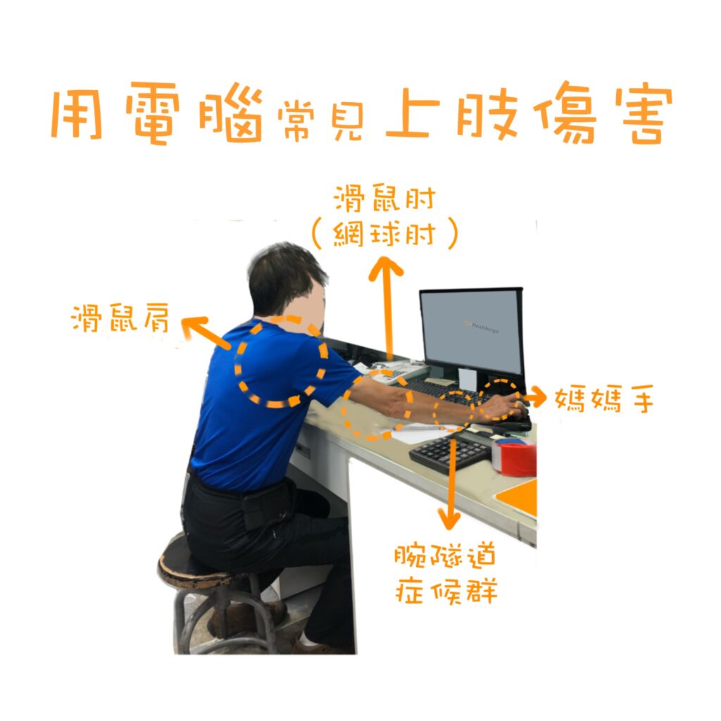 用電腦常見的人因性上肢肌肉骨骼傷害