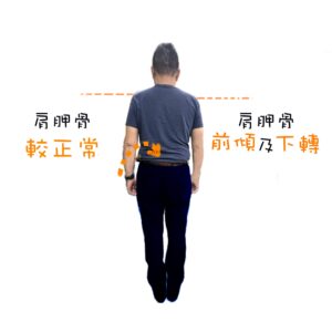人因肌肉骨骼站姿評估