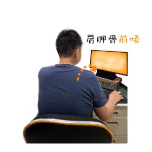人因肌肉骨骼:肩胛骨前傾