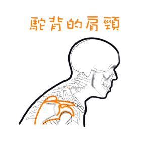 人因肌肉骨骼＿肩胛骨下轉及前傾。
